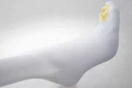 Alba Healthcare Anti-embolism Stocking Ultra C.A.R.E Thigh High Medium / Regular White Inspection Toe - M-649056-3217 | Case of 12
