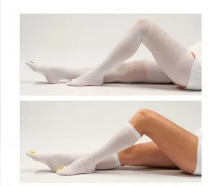 DJO Anti-embolism Stocking VenaFlow AES Thigh High Large / Regular Blue Inspection Toe - M-812651-1575 - Pack of 6
