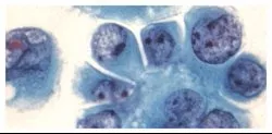 Fisher Scientific Acid Buffer Richard-Allan Scientific™ Phosphate Buffer pH 6.6 9.3 Gram - M-972776-807 - Case of 12