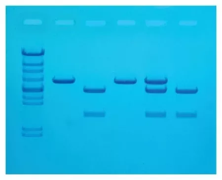 Fisher Scientific Cholesterol Diagnostics Educational Kit Edvotek™ 8 gels, Refrigerated - M-989399-1520 - Each