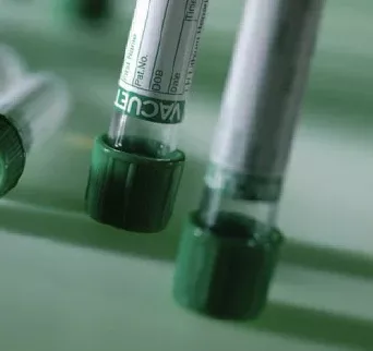 Fisher Scientific VACUETTE Venous Blood Collection Tube Analyte Determination Lithium Heparin Additive 13 X 75 mm 4 mL Green / Black Ring Pull Cap Polyethylene Terephthalate (PET) Tube - M-513920-2985 - Case of 1200