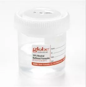 Globe Scientific Prefilled Formalin Container Tite-Rite™ 41 X 48 mm Polypropylene 45 mL in 90 mL (3 oz.) Screw Cap Warning Label / Patient Information NonSterile - M-926067-4533 - Case of 100