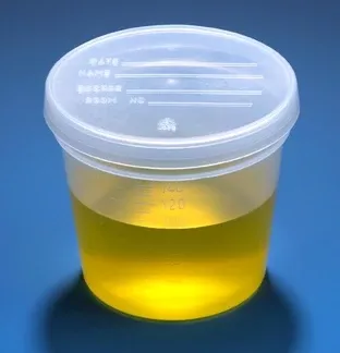 Globe Scientific Specimen Container 2-1/4 X 2-7/8 Inch Polypropylene 150 mL (5 oz.) Snap-On Lid Patient Information NonSterile - M-1135434-1822 - Case of 300
