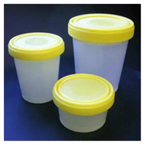 Globe ScientificContainer Histology 4-3/8x3-1/2" 500mL Clr PP Ylw ScrwCp 100/Ca