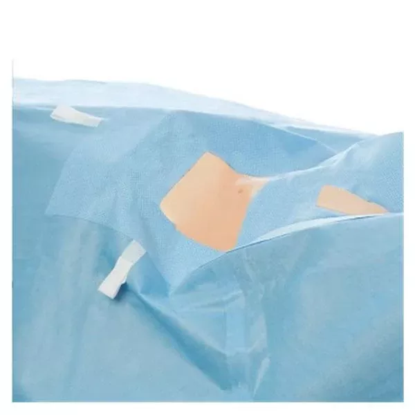 O & M Halyard Drape Laproscopy/Lithotomy Fenestrated 264x315cm Blue Strl 15/Ca