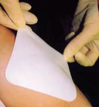 Smith & Nephew Wound Care Dressing Allevyn Fm 6x8" Thin Adh NAdh Semi-Transparent 3x16/Ca