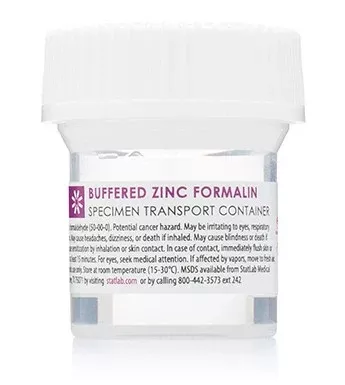 StatLab Medical Products Prefilled Formalin Container StatClick™ Polypropylene 10 mL Fill in 20 mL (0.67 oz.) Screw Cap Warning Label NonSterile - M-1030148-3403 - Case of 96