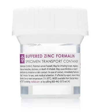 StatLab Medical Products Prefilled Formalin Container StatClick™ Polypropylene 20 mL Fill in 40 mL (1.35 oz.) Screw Cap Warning Label NonSterile - M-1030149-1875 - Case of 96