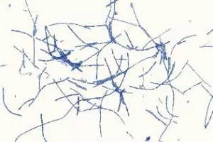 Ward's Science GRAM STAIN, BACTERIA TYPE SEPARATE SMEAR - M-1005499-3349 - Each