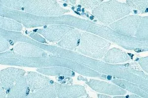 Ward's Science SLIDE MUSCLE TISSUE SKELETAL - M-955938-1709 - Each