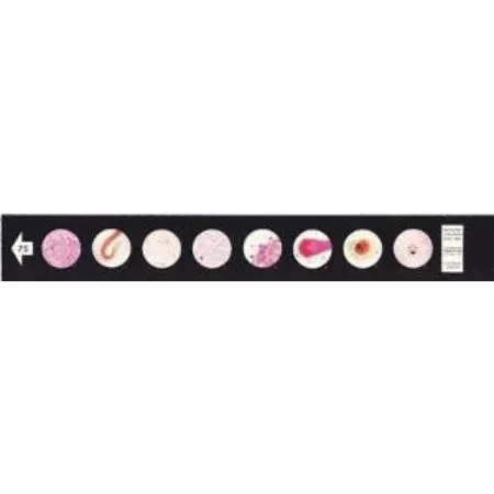Ward's Science Teaching Microscope Slide Animal Parasite 1 X 3 Inch - M-956352-1881 - Each
