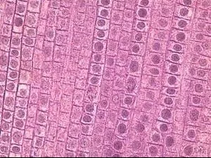 Ward's Science Teaching Microscope Slide Mitosis Fish / Onion 1 X 3 Inch - M-1005497-2544 - Box of 1