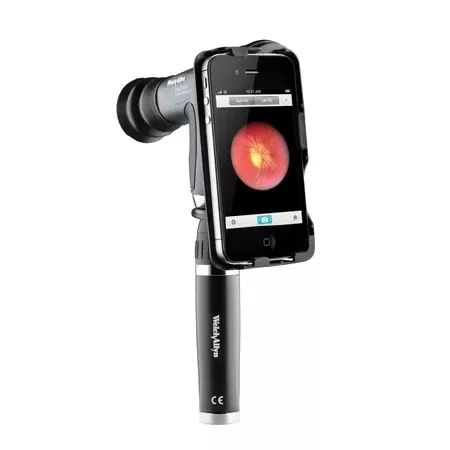 Welch Allyn Ophthalmoscope Adapter iExaminer Adapter for iPhone 6 and 6s For PanOptic Ophthalmoscope iPhone 6 and 6S - M-1016899-3042 | Each