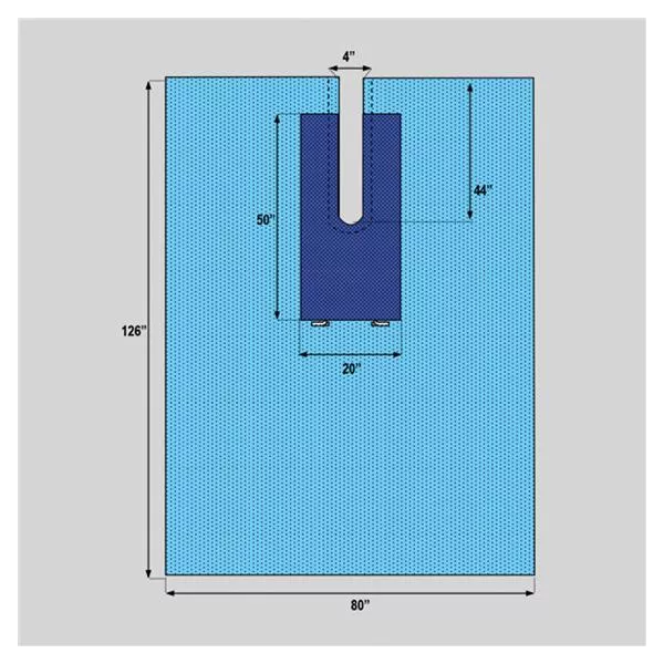 WelmedDrape Surgical Century Fenestrated 80x126" Sterile 20/Ca