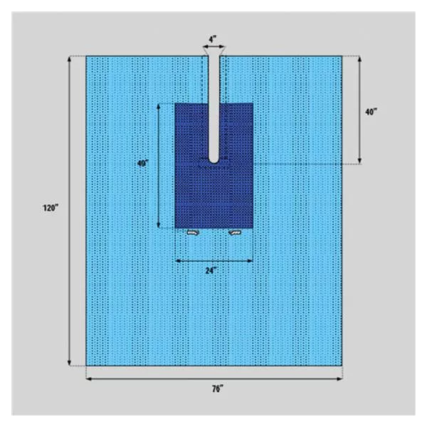 WelmedDrape Surgical Fenestrated 77x120" Non-Sterile 25/Ca