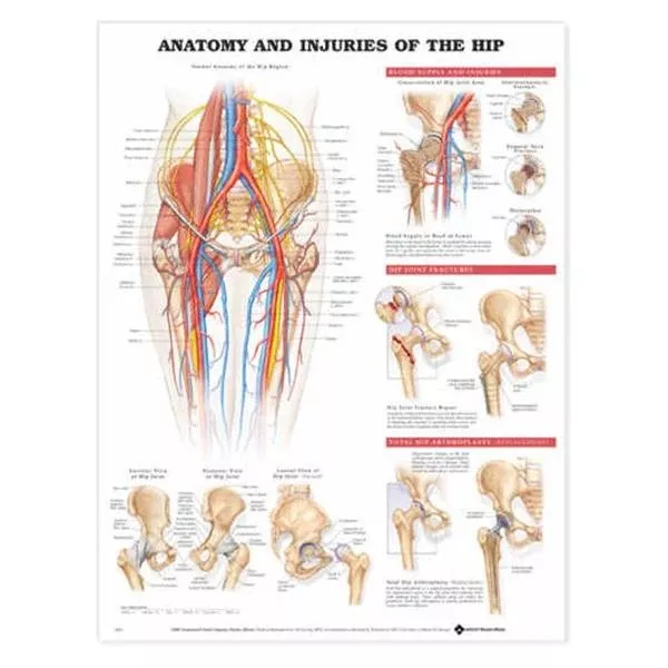 Wolters Kluwer HealthChart Anatomical Anatomy & Injuries of the Hip 20x26" Ea