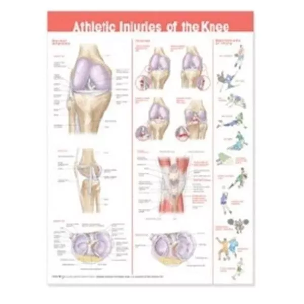 Wolters Kluwer HealthChart Anatomical Athletic Injuries of The Knee 20x26" Ea