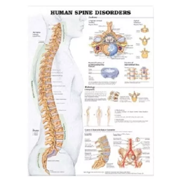 Wolters Kluwer HealthChart Clinical Spine Disorder 19" x 26" Ea