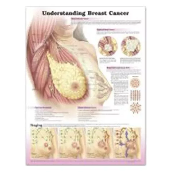 Wolters Kluwer HealthChart Educational Understanding Breast Cancer Spanish 20x26" Ea