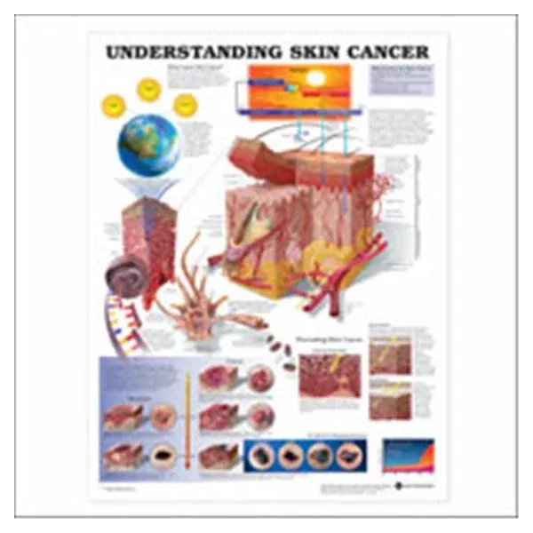 Wolters Kluwer HealthChart Educational Understanding Skin Cancer 20x26" Ea